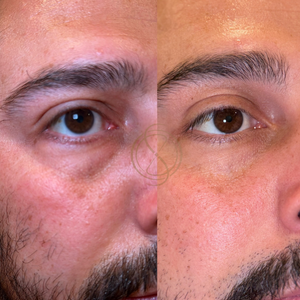 Pavise Precision Eye Lift Cream