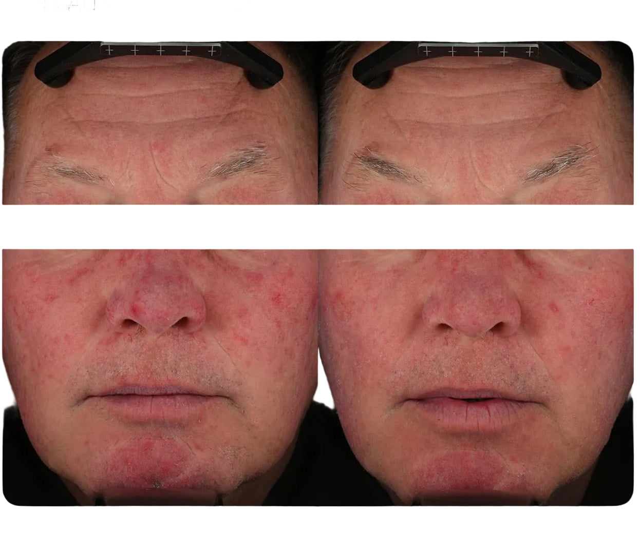 Pavīse Dynamic Age Defense SPF
