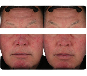 Pavīse Dynamic Age Defense SPF
